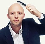 Обнаружены причины мужского облысения