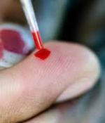 Количество ВИЧ-инфицированных в Южной Африке уменьшилось на треть