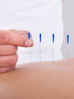Специалисты советуют обратить внимание на качество акупунктурных игл!