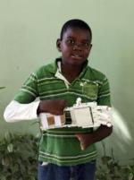 12-летний сирота из Гаити стал обладателем 3D-протеза руки