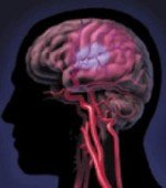 Специалисты  предупреждают - диетические добавки не лечат сотрясение мозга!