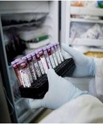 Ученые выявили новый метод лечения сепсиса
