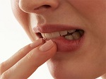 Бактерии, вызывающие пародонтит, также способствуют развитию ревматоидного артрита