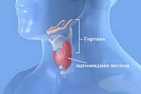 Рак щитовидной железы: лечение и профилактика