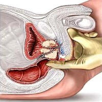 Рак предстательной железы: симптомы болезни