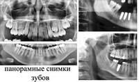 Панорамный снимок зубов где сделать